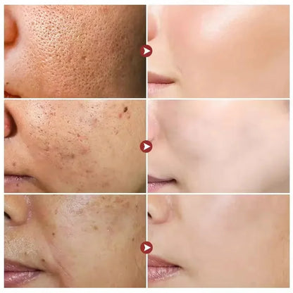White Rice Whitening Serum Wrinkle Remover Fade Fine Lines Remove Dark Spots Melanin Anti-aging Brighten Smooth Face Skin Care